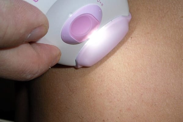 Depilación en verano: cuchilla, cera o láser, ¿qué le conviene a tu piel?